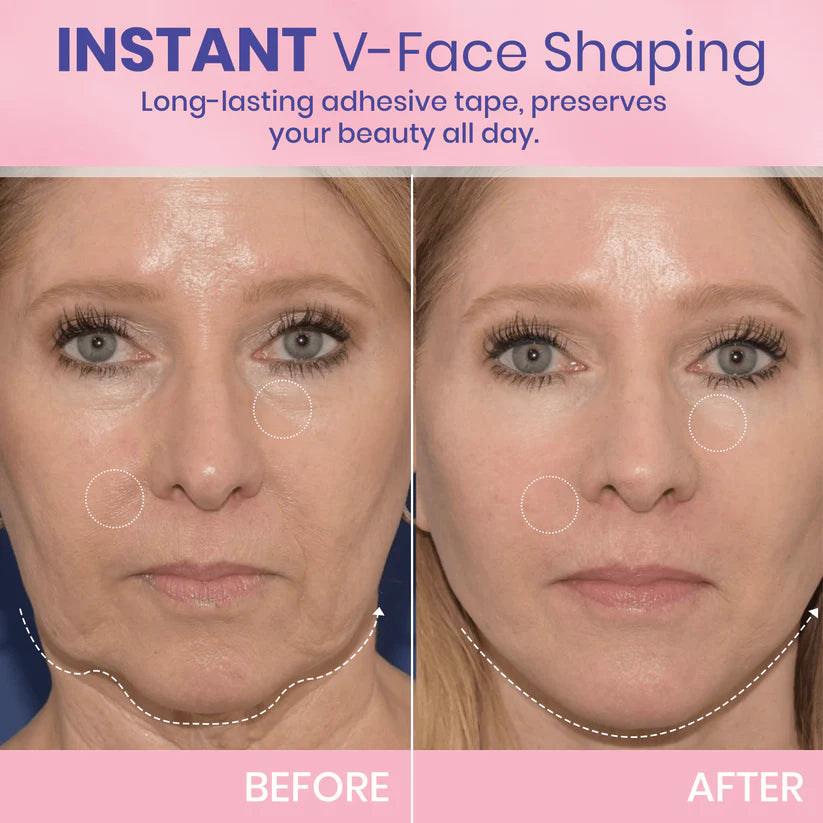 Faugettt™ V-Face Lifting Adhesive Tape