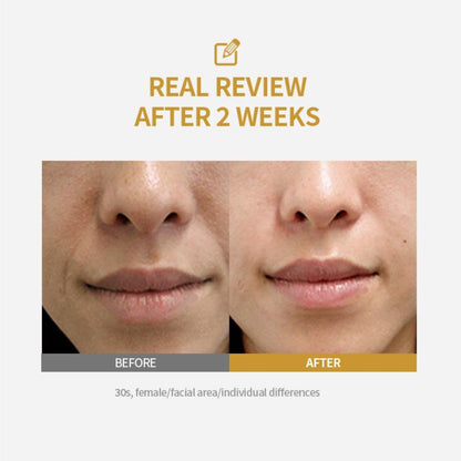 Peptide Lifting Ampoule – Anti-Aging & Firming Serum