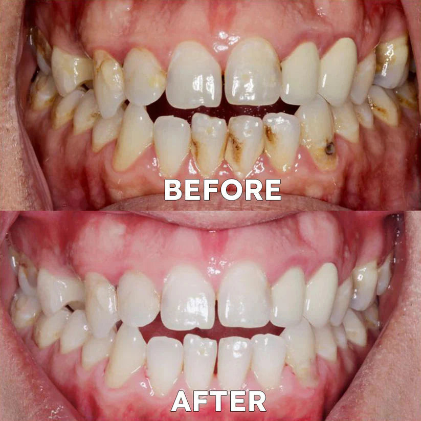 Ourlyard™ Tooth Powder