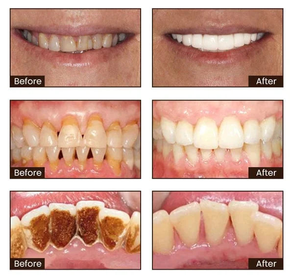 Niacinamide Whitening Toothpaste