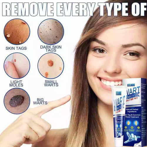 WartAway Herbal Removal Cream